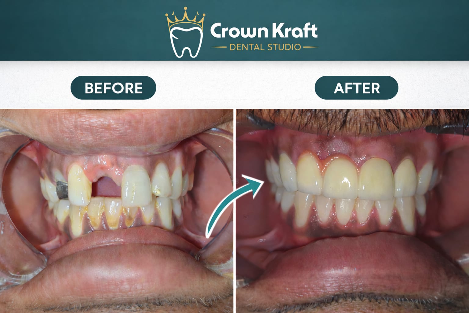 Before and after dental treatment